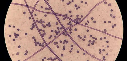 Anti-fungal